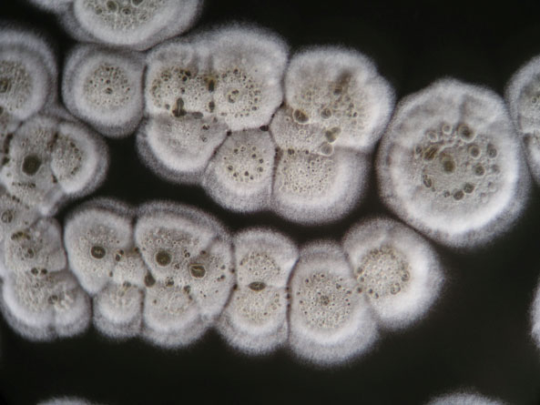 Strahlenpilz Streptomyces